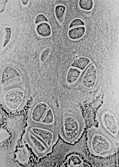 Hyaline cartilage