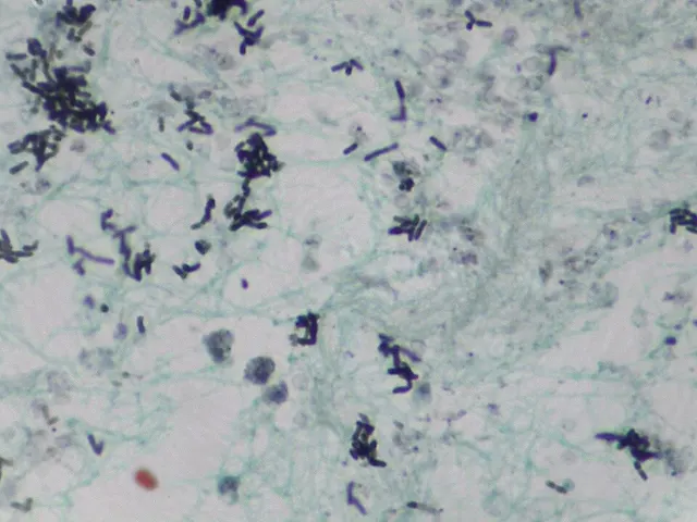 Geotrichum