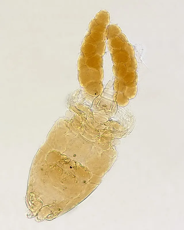 Abergasilus
