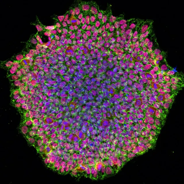 Induced pluripotent stem cell
