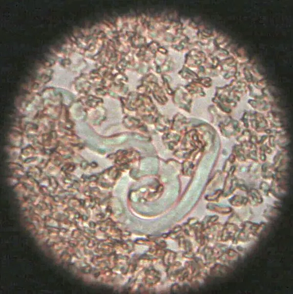 Spirurida