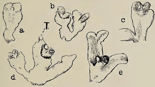 Aitchisoniella