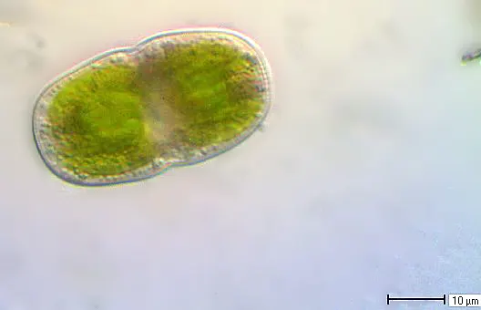Actinotaenium