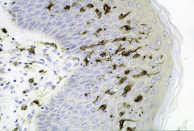Cellule dendritique
