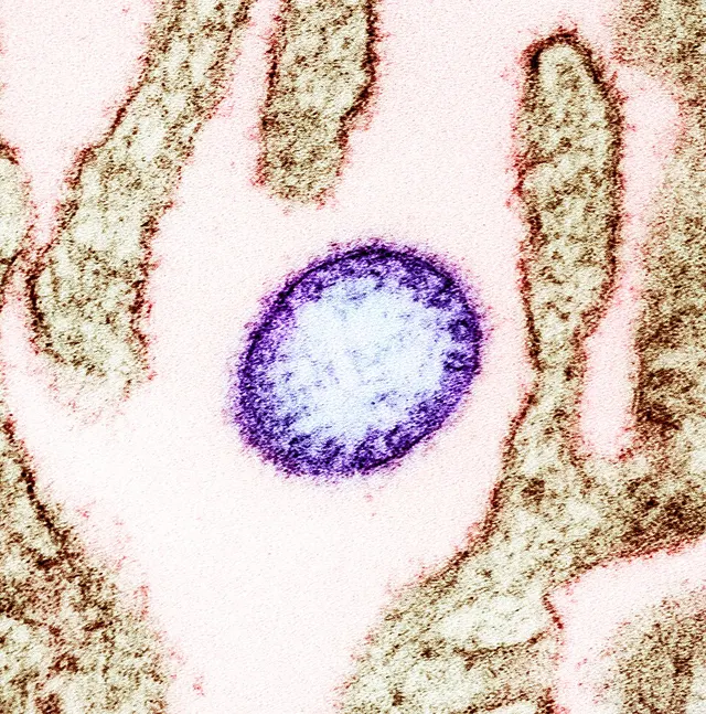 Virus de Nipah