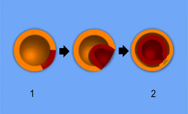 Embryology
