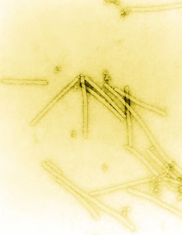 Virus de la mosaïque du tabac