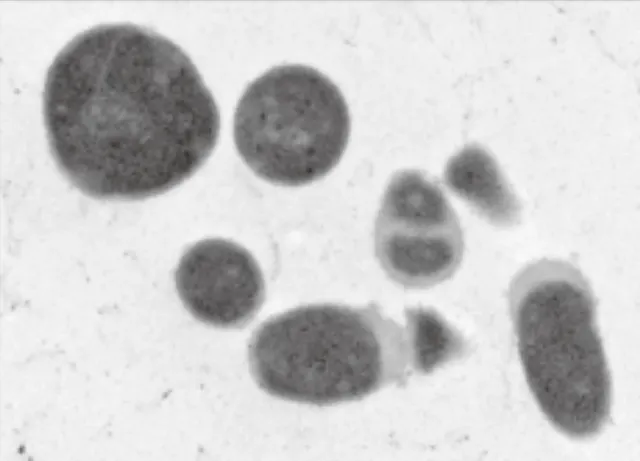 Solobacterium moorei