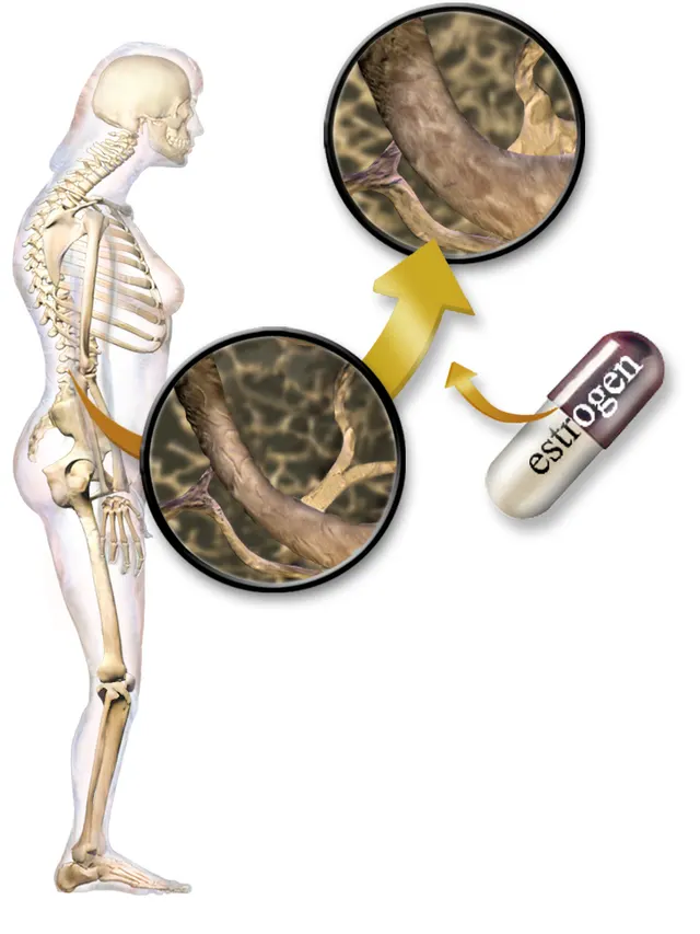 Hormone replacement therapy