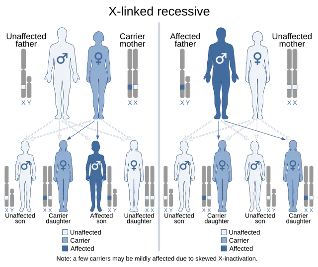 Haemophilia B