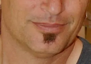 Soul patch