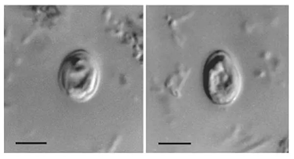 Cryptosporidium