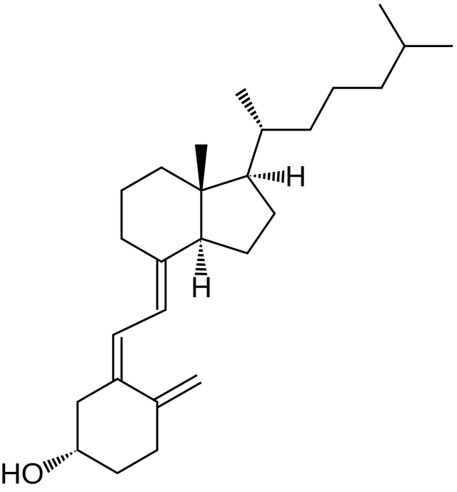 Vitamin D toxicity