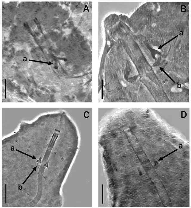 Mesocrista