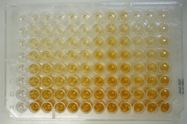 Palaeoimmunology