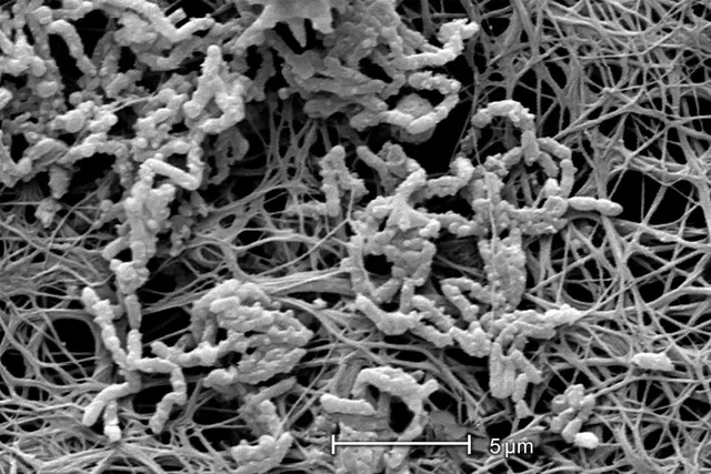 Achromobacter xylosoxidans