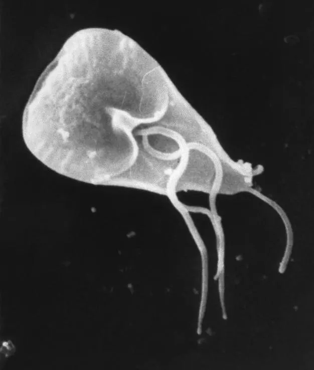 Giardiase