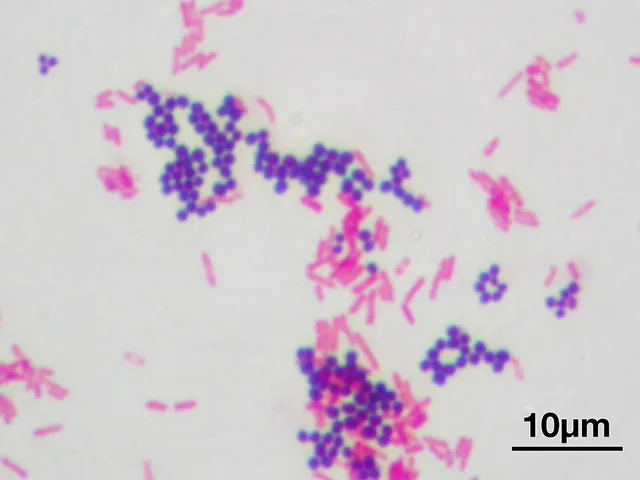 Infectious diseases