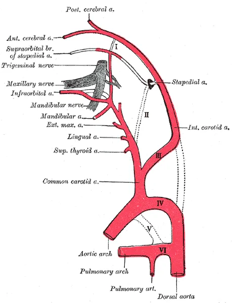 Persistent stapedial artery
