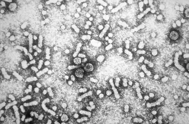 Viral transformation