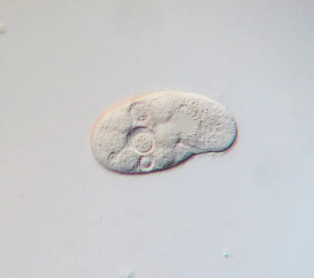 Colpidium colpoda