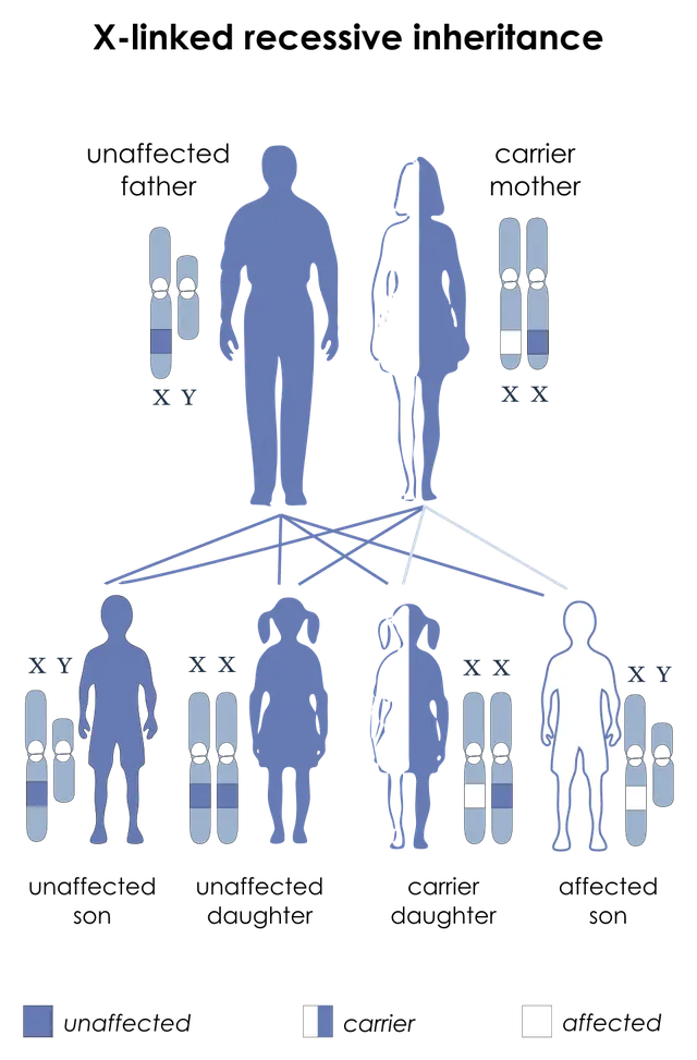 X-linked dystonia parkinsonism