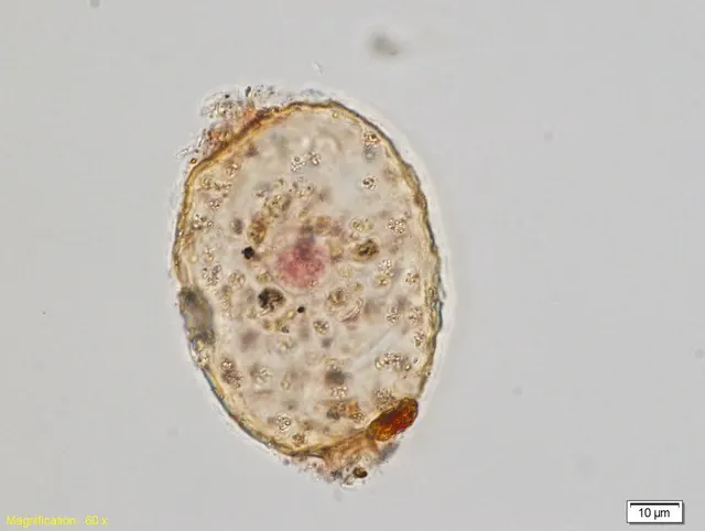 Amphitrema