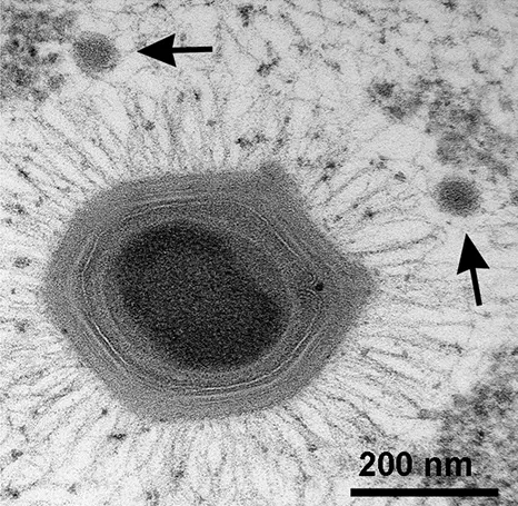 Mimivirus