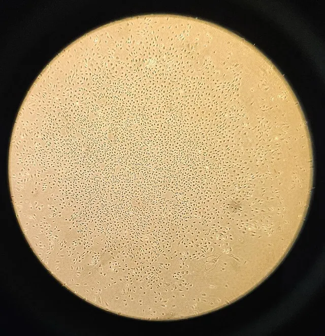 Human lung microvascular endothelial cell